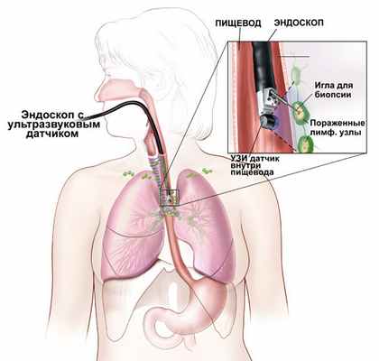 Исследование ЖКТ
