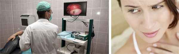 Эндоскопический метод обследования пищевода