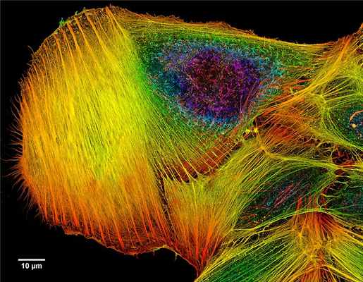 Клеточный «скелет» из микротрубочек, покрашенный флуоресцентным красителем. Клетка, кстати, злокачественная. Howard Vindin / CC BY-SA 4.0 