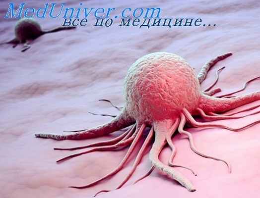 алкилирующие препараты