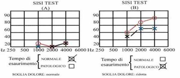 феномен выравнивания громкости звука-2