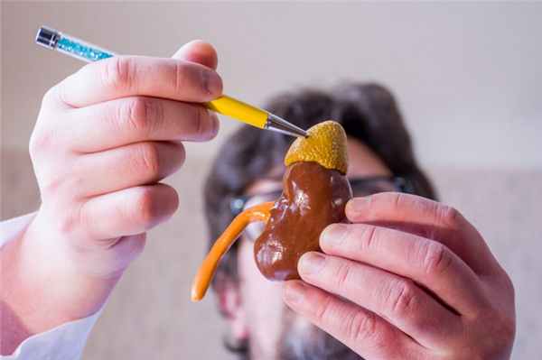 Феохромоцитома