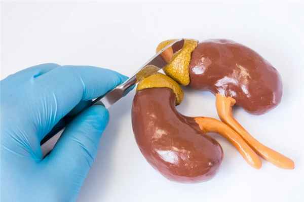 Феохромоцитома