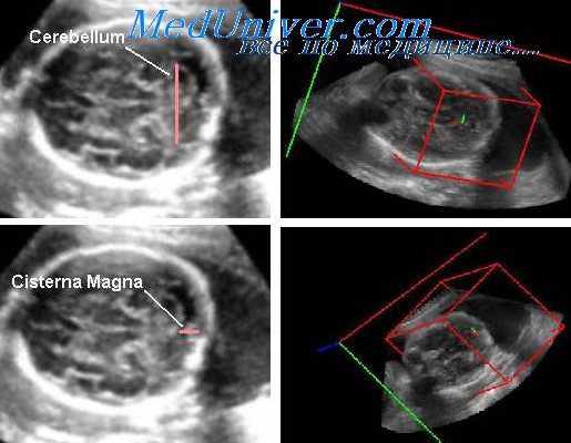 фетометрия