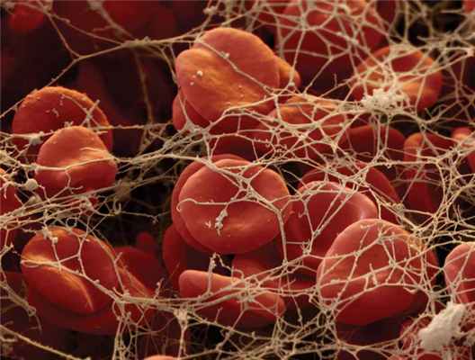 Фибриноген – что это такое?