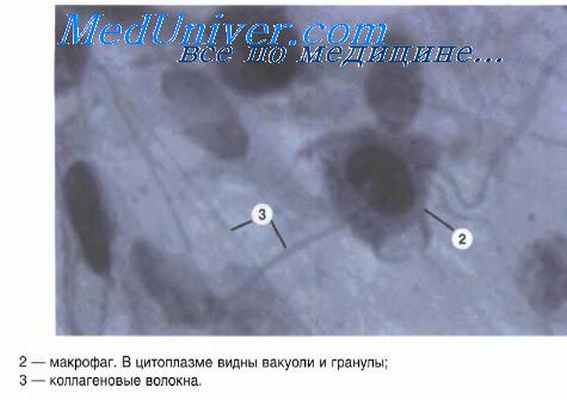 фибробласты