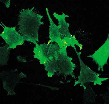 PIP₃ – сигнальная молекула, координирующая работу всех структур, которые фибробласт использует для передвижения. PIP₃ способна связываться с флуоресцентным белком, поэтому на микрофотографиях ярче окрашен передний край клетки, где концентрация PIP₃ выше. Именно там располагаются ламеллоподии – листообразные выросты, которыми клетка при движении прикрепляется к коллагеновому волокну. Конфокальная флуоресцентная микроскопия (микроскоп Leica SP5)