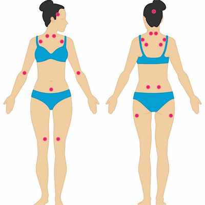 Соблюдение особого образа жизни при фибромиалгии