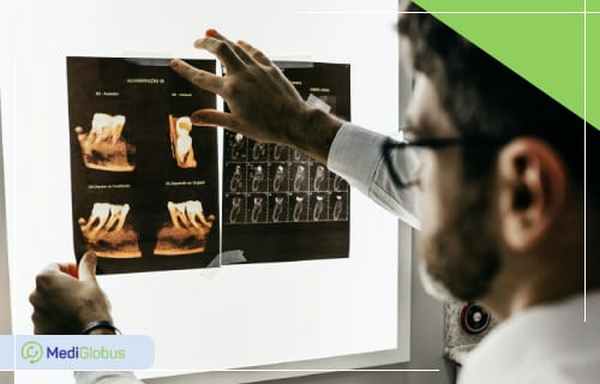 фиброзная дисплазия рентген кт диагностика