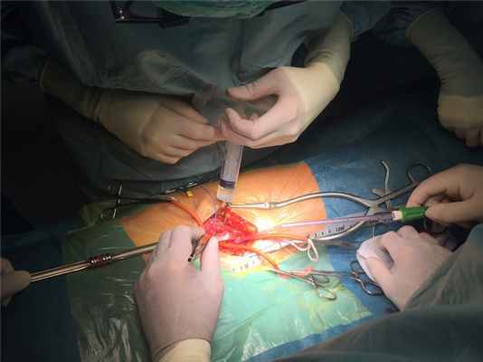 Отделение сосудистой и эндокринной хирургии