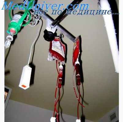 эритроцитарная масса