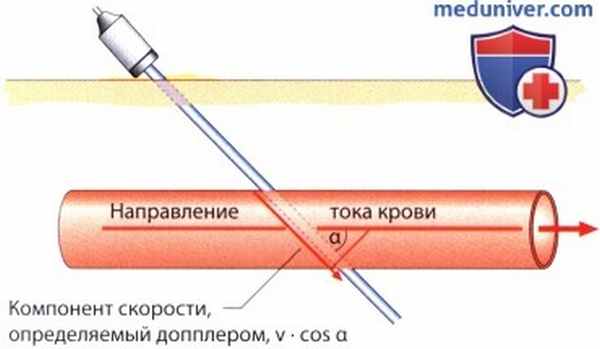 Физические принципы допплер-эхокардиографии (допплер-ЭхоКГ)