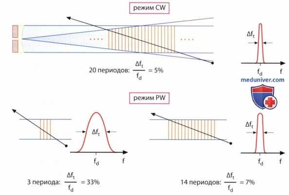 Физические принципы допплер-эхокардиографии (допплер-ЭхоКГ)