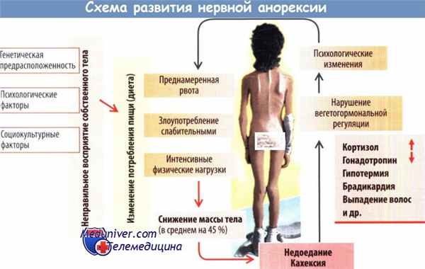 Физиология истощения. Анорексия и кахексия