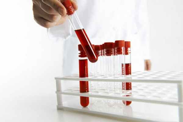 Диагностика рожистого воспаления