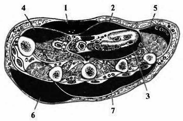 Локализация флегмон на ладонной и тыльной поверхностях кисти