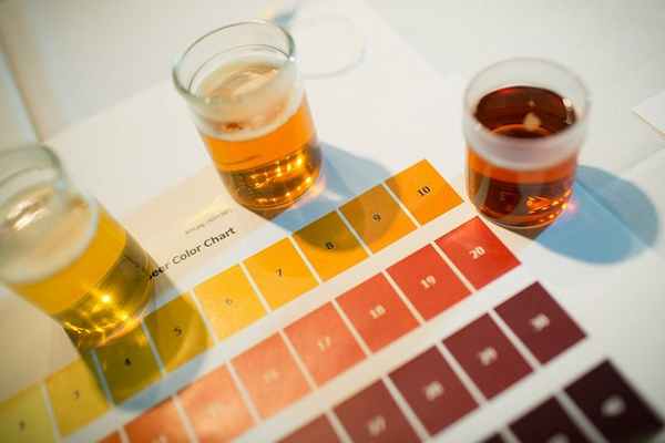 Диагностика заболевания