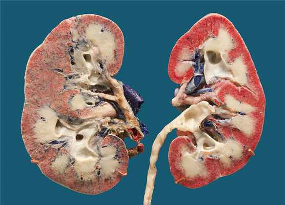 Человеческая почка в разрезе