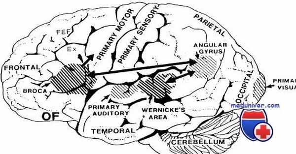 лечение дизартрии