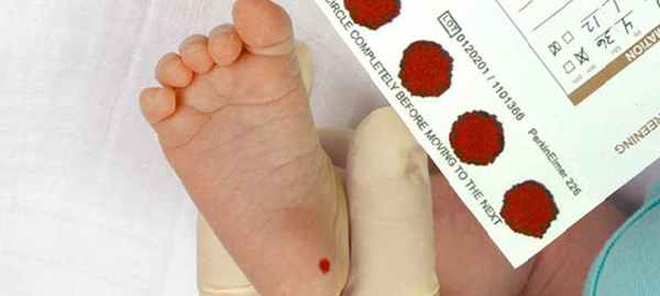 Массовое обследование новорожденных на наследственные болезни. Галактоземия