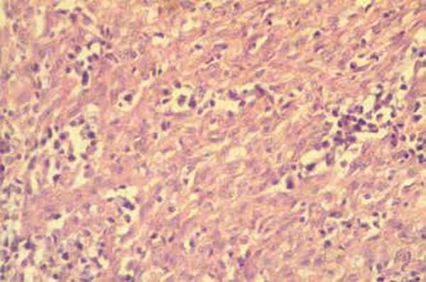 МОРФОЛОГИЧЕСКАЯ ХАРАКТЕРИСТИКА И ИММУНОФЕНОТИП ГАСТРОИНТЕСТИНАЛЬНЫХ СТРОМАЛЬНЫХ ОПУХОЛЕЙ МЕЛКИХ ДОМАШНИХ ЖИВОТНЫХ/MORPHOLOGICAL CHARACTERISTICS AND IMMUNOPHENOTYPE OF GASTROINTESTINAL STROMAL TUMORS OF SMALL ANIMALS