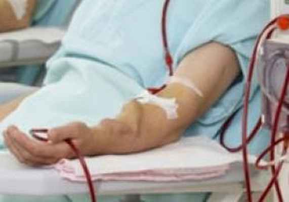 Гемодиализ, его особенности