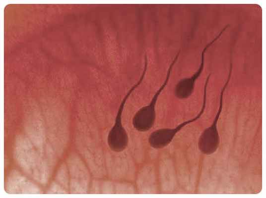 гемоспермия