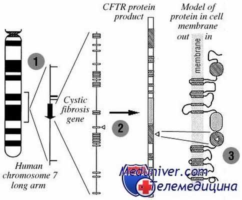 генетика муковисцидоза
