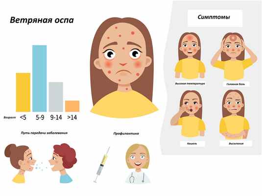 Ветряна оспа.jpg