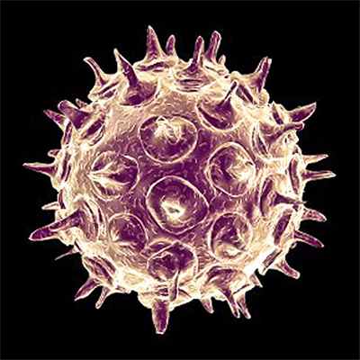 Вирус герпеса 3 типа