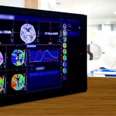 Гидроцефалия