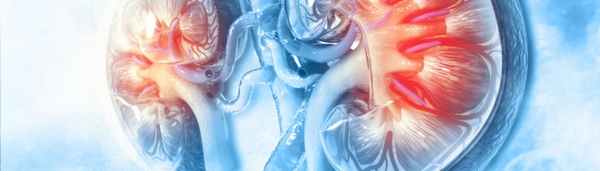  Гиперфосфатемия при хронической болезни почек