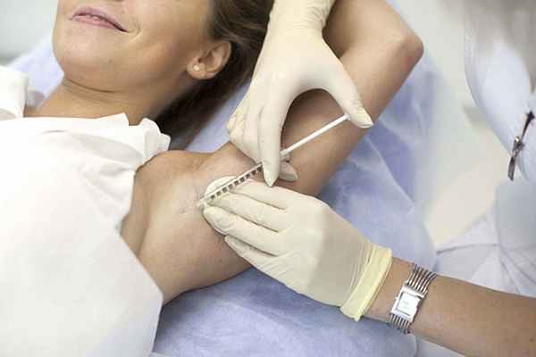 Лечение гипергидроза