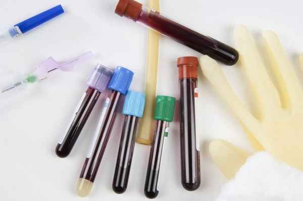 Повышенный калий в крови: возможные причины и терапия