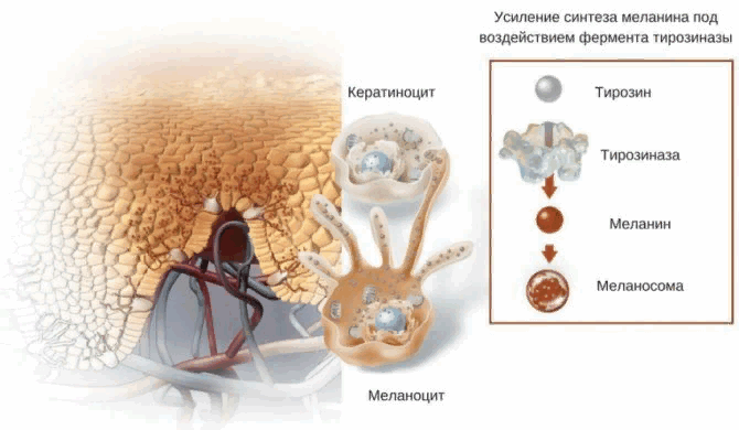 Патогенез гиперпигментации кожи