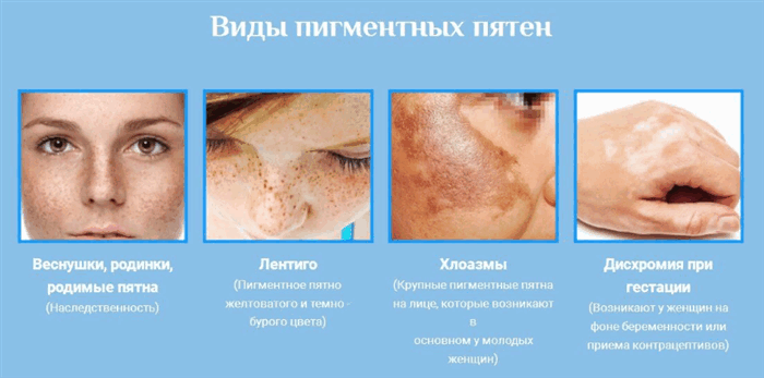 Классификация и стадии развития