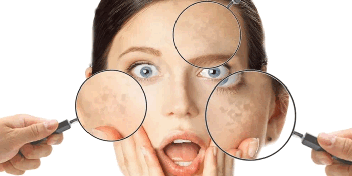 Определение и причины заболевания