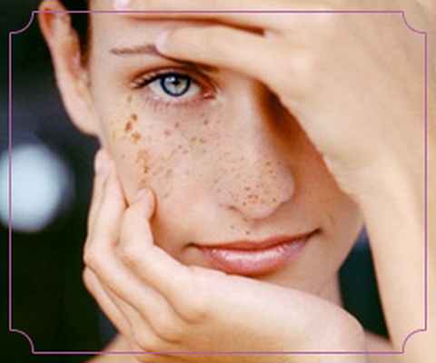 Гиперпигментация