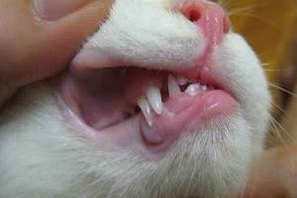 Лечение гиперплазии десен