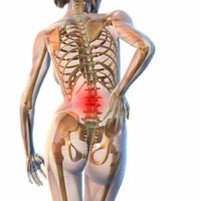 Мышечно-тонический синдром