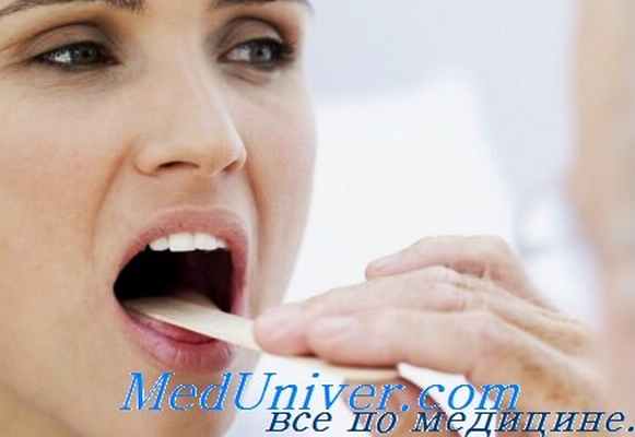 гипертрофия язычной миндалины