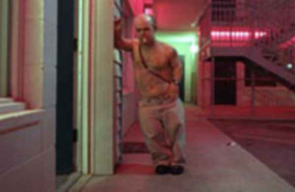 Карликовость (гипофизарный нанизм)