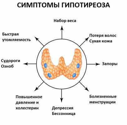 Симптомы гипотиреоза.jpg