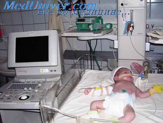 гипотензия у ребенка