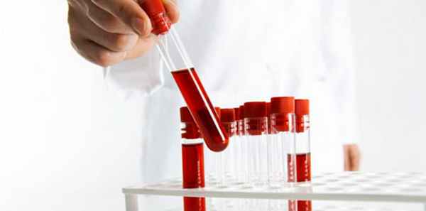 Признаки гиповолемического расстройства – Алкоклиник