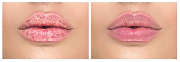 Хейлит виды