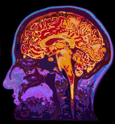 Зачем нужен головной мозг? Функции мозга