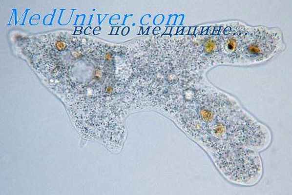 амебный энцефалит