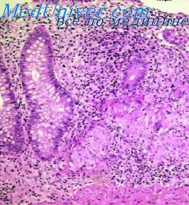 дерматомикозы