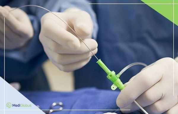 биопсия фолликулярной лимфомы